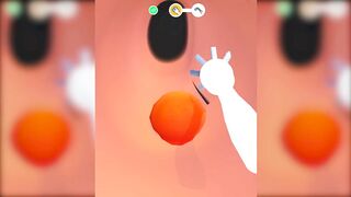 EarWax Clinic Games All Levels Gameplay Video Android, iOS 183YHFOZX