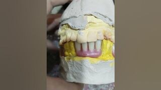 Flexible Lower Removable Partial Denture Ready For Try In ????????????#rpd#flexible #dentures #denture