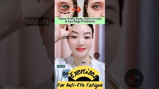 Solve Puffy Eyes, Dark Circles & Eye Bags Problems #faceyoga #facialyoga #yoga #eyelift #shorts